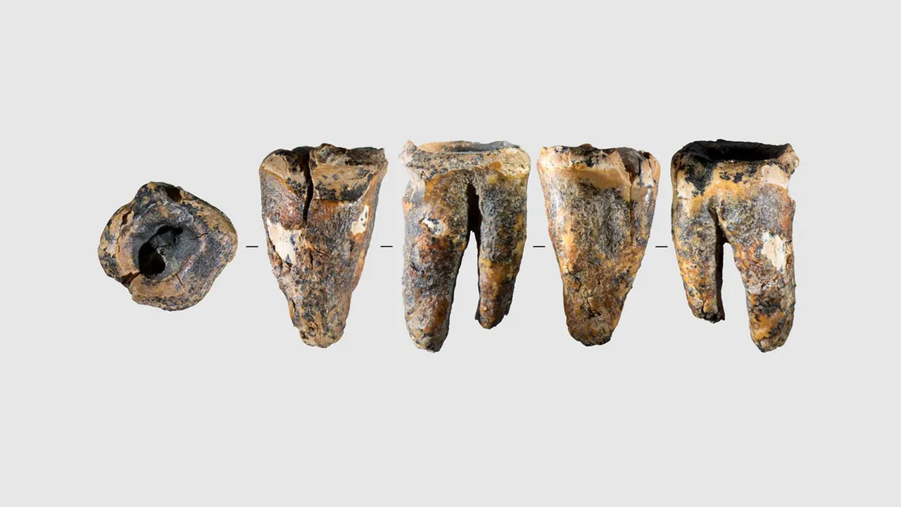 59 Bin Yıllık Diş: Neandertallerin Cerrahi Yeteneği Gözler Önüne Serildi
